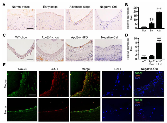 RGC-32 缺失可保護內皮細胞免受炎癥損傷并減輕動脈粥樣硬化